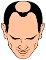 Tipo 5